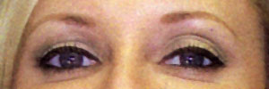 After permanent eyebrows